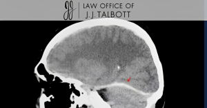 A grayscale brain scan with a red arrow pointing to a specific area, overlaid with the text "Law Office of J.J. Talbott" at the top.