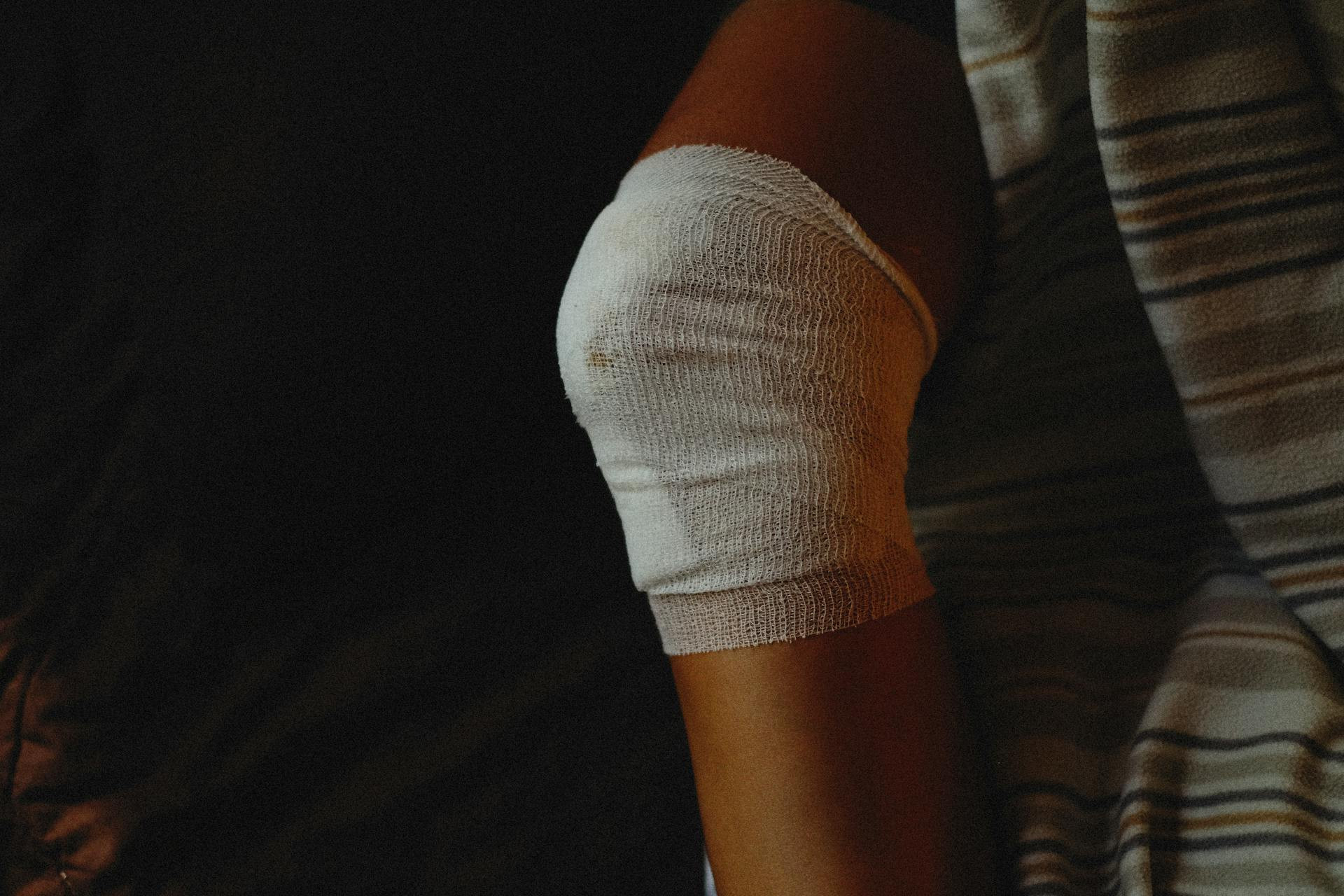 A person's knee wrapped in white bandages, resting on a striped blanket.